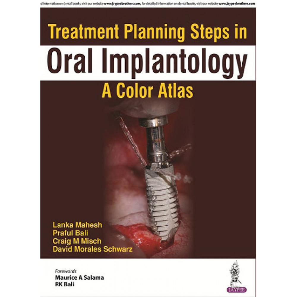 Treatment Planning Steps in Oral Implantology: A Color Atlas;1st Edition 2018 By Lanka Mahesh