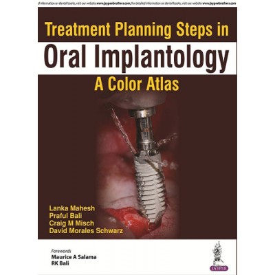 Treatment Planning Steps in Oral Implantology: A Color Atlas;1st Edition 2018 By Lanka Mahesh