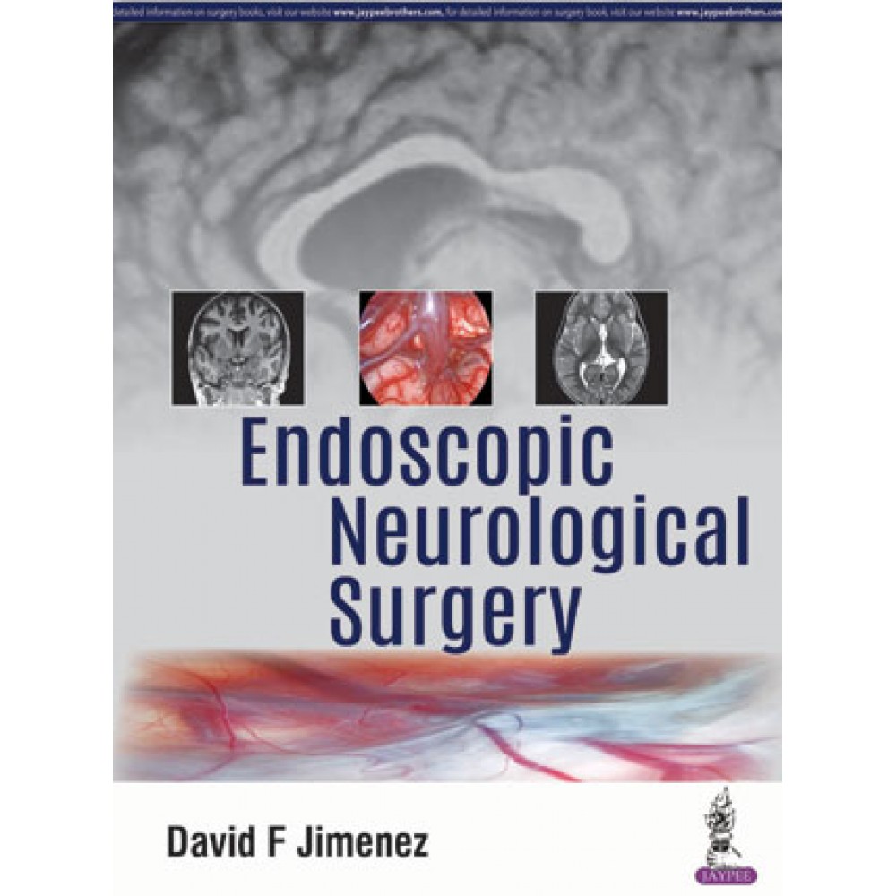 Endoscopic Neurological Surgery;1st Edition 2019 By David F Jimenez