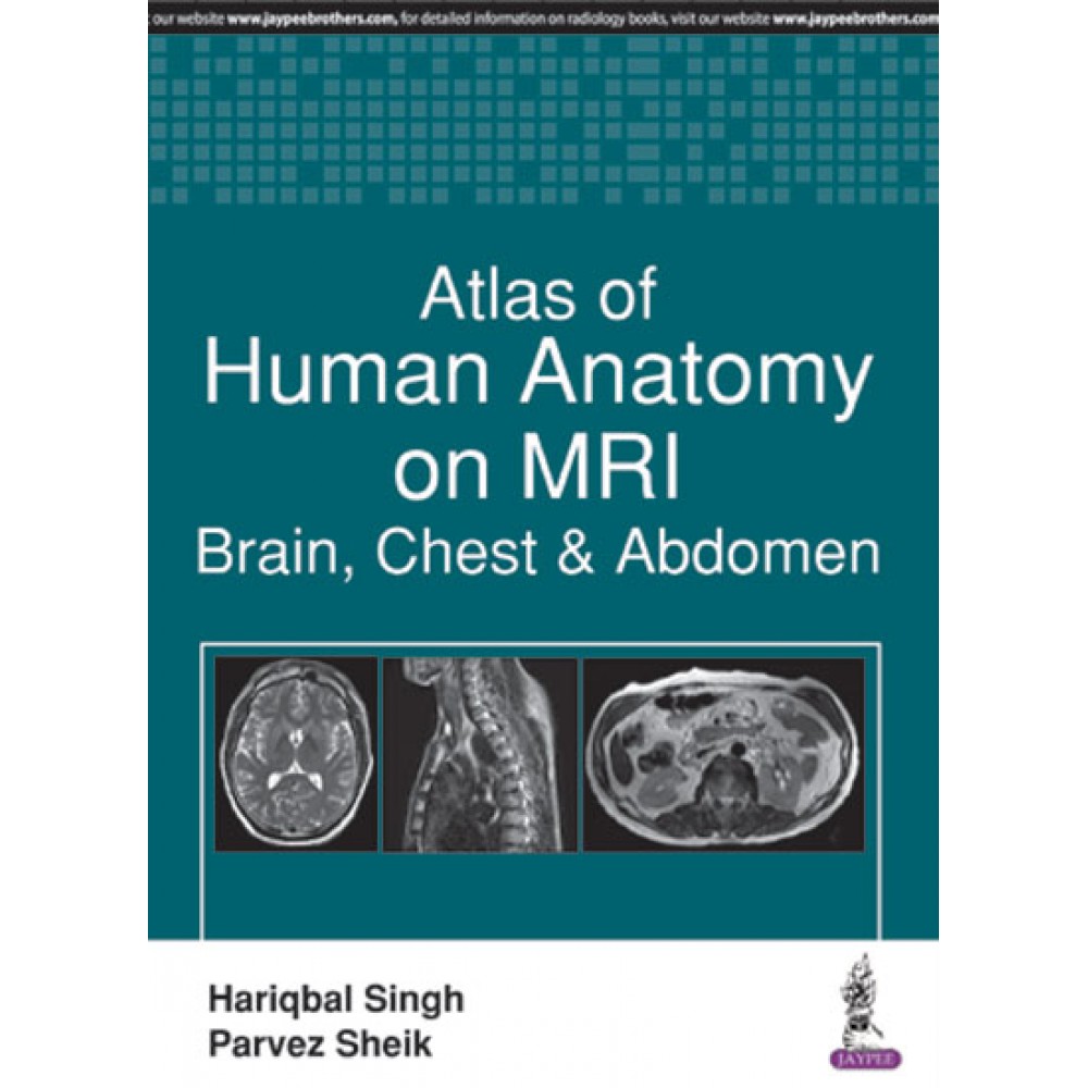 Atlas of Human Anatomy on MRI Brain, Chest and Abdomen;1st Edition 2017 By Hariqbal Singh Parvez Sheik