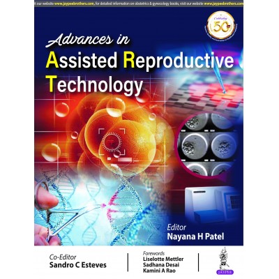 Advances in Assisted Reproductive Technology;1st Edition 2020 By Nayana H Patel & Sandro C Esteves