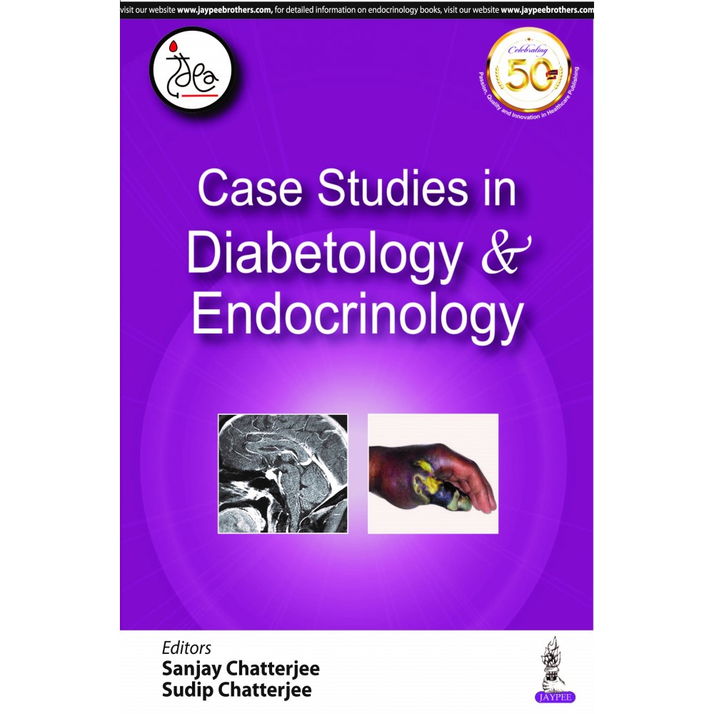 Case Studies in Diabetology & Endocrinology;1st Edition 2020 By Sanjay Chatterjeest 