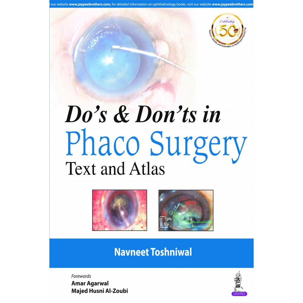 Do’s & Don’ts in Phaco Surgery: 2020 By Navneet Toshniwal