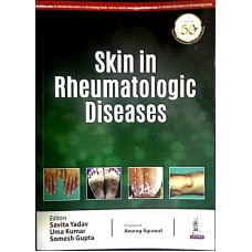 Skin In Rheumatologic Diseases;1st Edition 2020 By Savita Yadav, Uma Kumar,Somesh Gupta & Anurag Agrawal