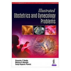 Illustrated Obstetrics and Gynecology Problems;1st Edition 2020 by Sireesha Y Reddy