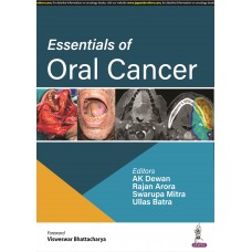 Essentials of Oral Cancer;1st Edition 2022 By Ak Dewan, Rajan Arora, Swarupa Mitra & Ullas Batra