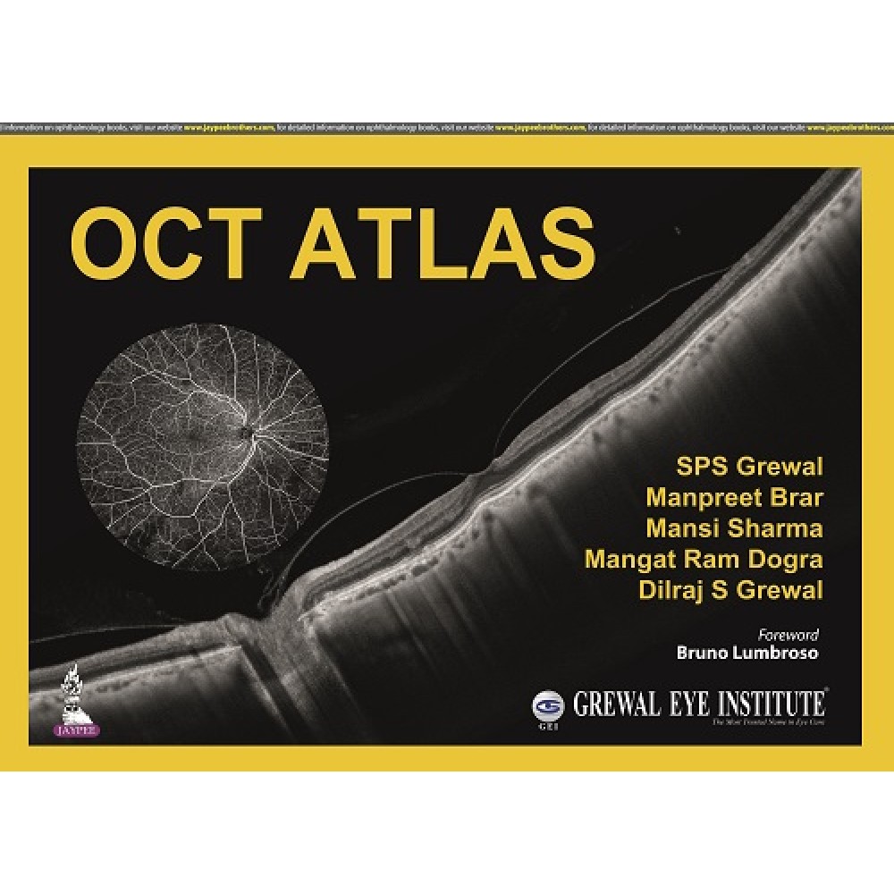OCT Atlas;1st Edition 2022 By SPS Grewal & Manpreet Brar
