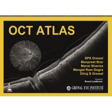 OCT Atlas;1st Edition 2022 By SPS Grewal & Manpreet Brar