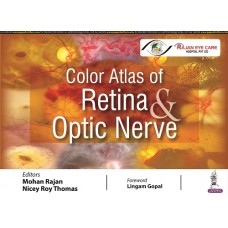 Color Atlas of Retina & Optic Nerve;1st Edition 2022 By Mohan Rajan & Nicey Roy Thomas