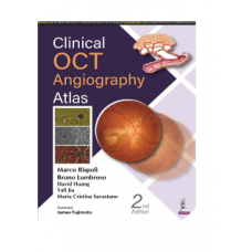 Clinical OCT Angiography Atlas;2nd Edition 2022 by Marco Rispoli, Bruno Lumbroso & David Huang