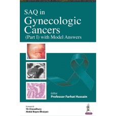 SAQ in Gynaecologic Cancers (Part 1) with Model Answers;1st Edition 2022 By Professor Farhat Hussain
