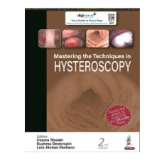 Mastering the Techniques in Hysteroscopy; 2nd Edition 2022 by Osama Shawki & Sushma Deshmukh