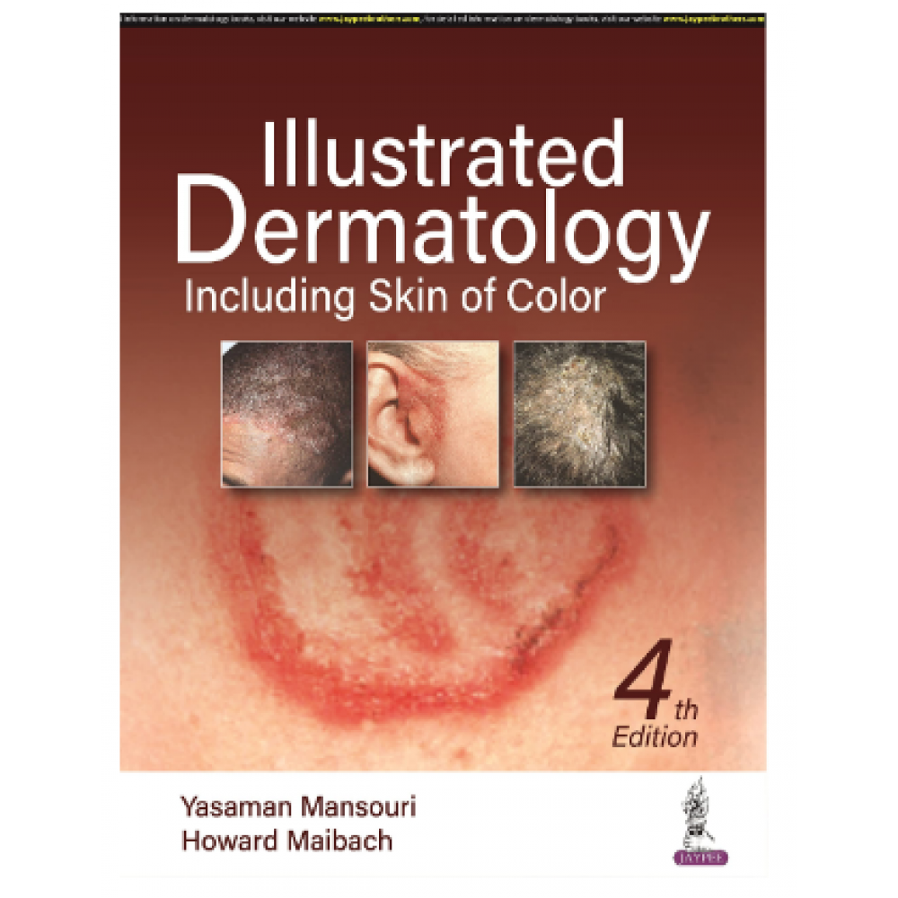 Illustrated Dermatology (Including Skin of Color);4th Editin 2023 by Yasaman Mansouri & Howard Maibach