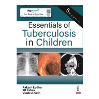 Essentials of Tuberculosis in Children; 5th Edition 2023 by Rakesh Lodha, SK Kabra & Vimlesh Seth
