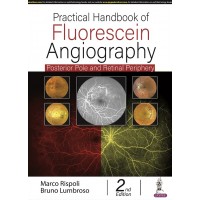 Practical Handbook of Fluorescein Angiography: Posterior and Retinal Periphery;2nd Edition 2022 by Marco Rispoli & Bruno Lumbroso