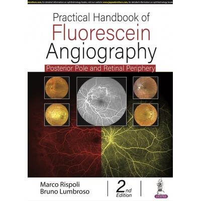 Practical Handbook of Fluorescein Angiography: Posterior and Retinal Periphery;2nd Edition 2022 by Marco Rispoli & Bruno Lumbroso