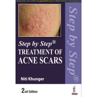 Step By Step Treatment Of Acne Scars; 2nd Edition 2022 by Niti Khunger