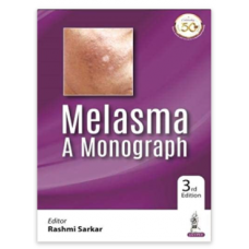 Melasma: A Monograph;3rd Edition 2022 by Rashmi Sarkar