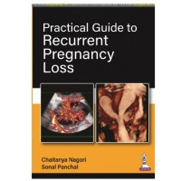 Practical Guide to Recurrent Pregnancy Loss;1st Edition 2023 By Chaitanya Nagori & Sonal Panchal	