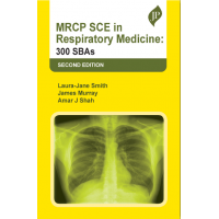 MRCP SCE in Respiratory Medicine: 300 SBAs;2nd Edition 2023 by Laura-Jane Smith, James Murray & Amar J Shah