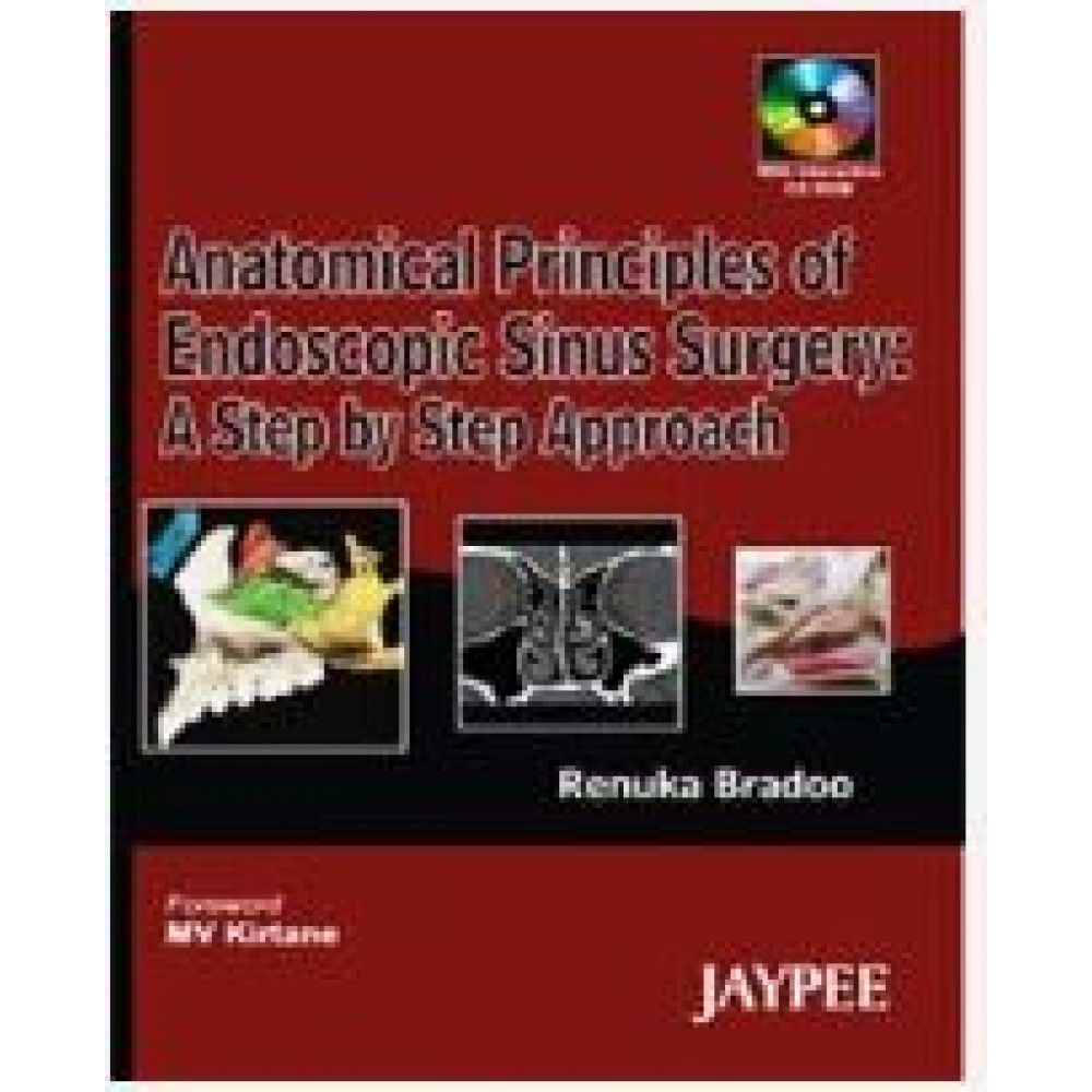 Anatomical Principles of Endoscopic Sinus Surgery:A Step by Step Approach;1st Edition(Reprint) 2012 By Renuka Bradoo