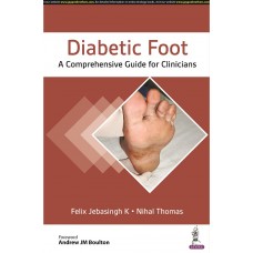 Diabetic Foot A Comprehensive Guide to Clinicians;1st Edition 2023 By Felix Jebasingh K & Nihal Thomas