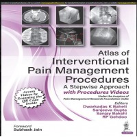 Atlas of Interventional Pain Management Procedures: A Stepwise Approach;1st Edition 2023 By  Dwarkadas K Baheti, Sanjeeva Gupta, et al