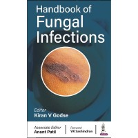 Handbook of Fungal Infections:1st Edition 2023 By Kiran Godse & Anant Patil