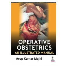 Operative Obstetrics: An Illustrated Manual;1st Edition 2023 by Arup Kumar Majhi