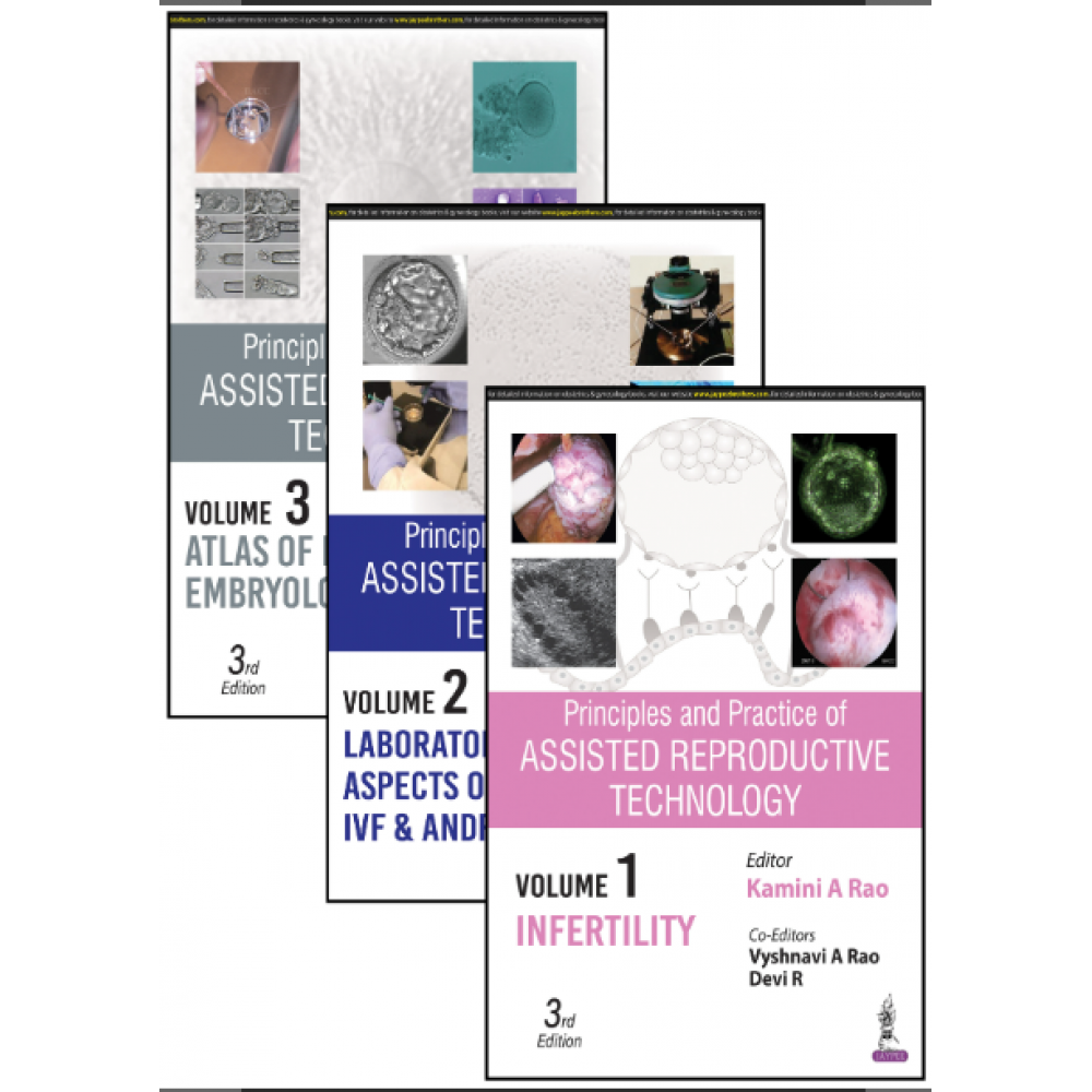 Principles and Practice of Assisted Reproductive Technology (3 Volumes);3rd Edition 2023 By Kamini A Rao & Vyshnavi A Rao