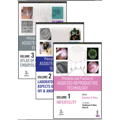 Principles and Practice of Assisted Reproductive Technology (3 Volumes);3rd Edition 2023 By Kamini A Rao & Vyshnavi A Rao