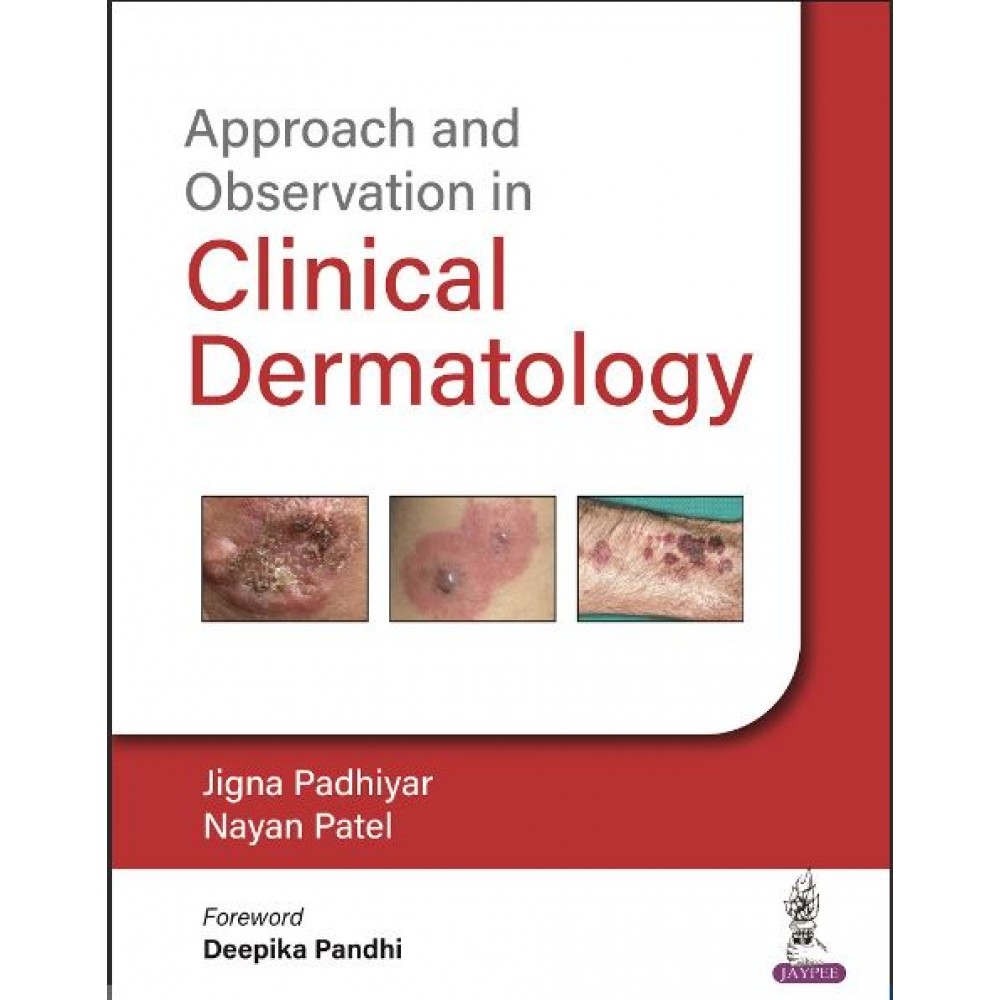 Approach And Observation In Clinical Dermatology:1st Edition 2023 By Jigna Padhiyar & Nayan Patel