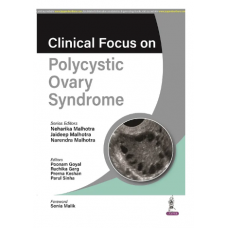 Clinical Focus on Polycystic Ovary Syndrome;1st Edition 2023 by Neharika Malhotra, Jaideep Malhotra & Narendra Malhotra