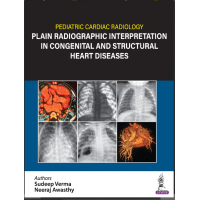 Pediatric Cardiac Radiology Plain Radiographic Interpretation in Congenital and Structural Heart Diseases;1st Edition 2024 by Sudeep Verma & Neeraj Awasthy