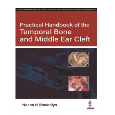 Practical Handbook of the Temporal Bone and Middle Ear Cleft;1st Edition 2023 by Neena H Bhalodiya