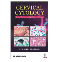 Cervical Cytology Special Emphasis On Liquid-Based Cytology;2nd Edition 2024 By Pranab Dey