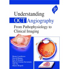 Understanding OCT Angiography From Pathophysiology to Clinical Imaging;1st Edition 2020 by Bruno Lumbroso & David Huang