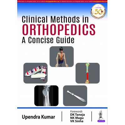 Clinical Methods in Orthopedics:A Concise Guide;1st Edition 2020 by Upendra Kumar