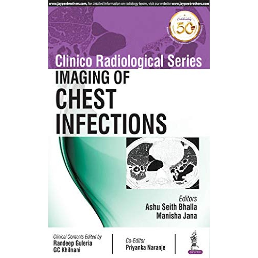 Clinico Radiological Series:Imaging of Chest Infections;1st Edition 2019 By Ashu Seith Bhalla & Manisha Jana