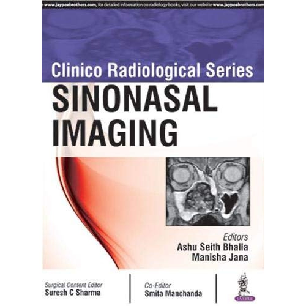 Clinico Radiological Series: Sinonasal Imaging;1st Edition 2018 By Ashu Seith bhalla & Manisha Jana