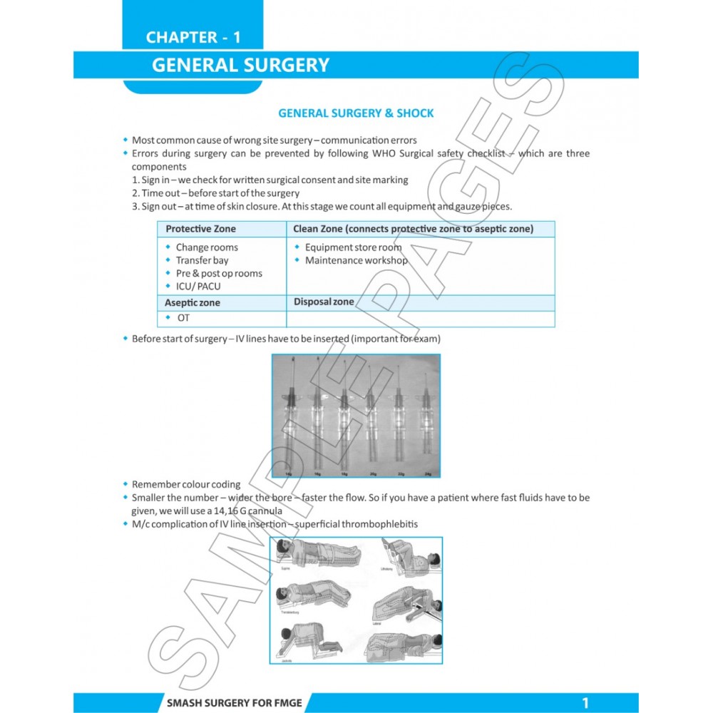 Smash Surgery For Fmge;1st Edition 2019 By Dr. Rohan khandelwal