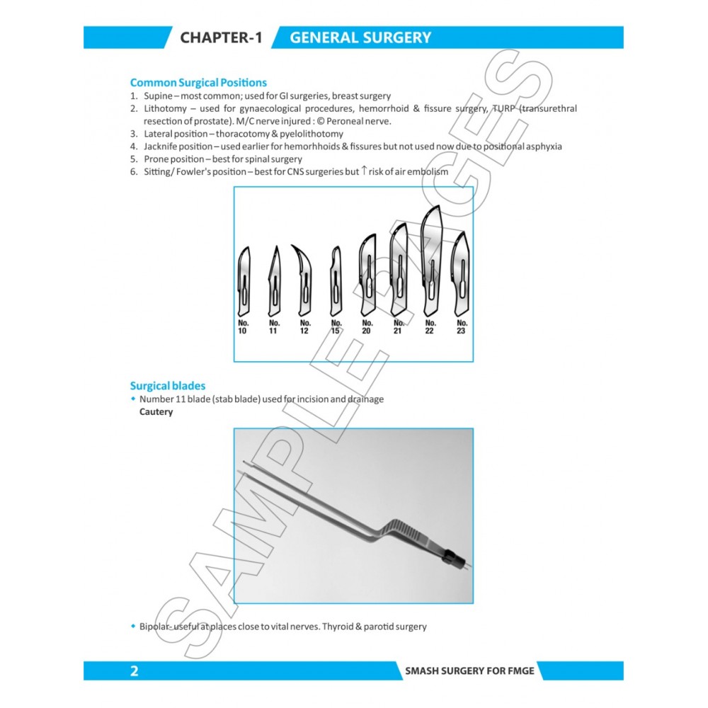 Smash Surgery For Fmge;1st Edition 2019 By Dr. Rohan khandelwal