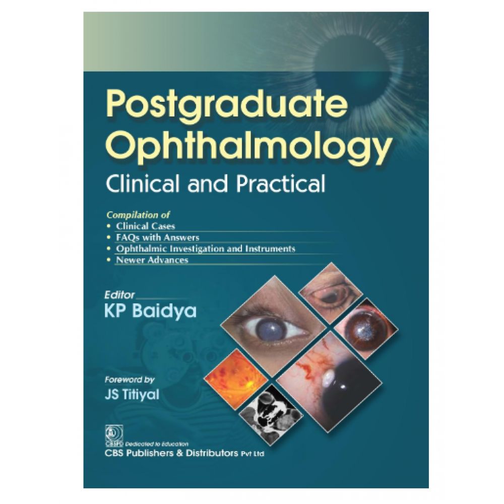 Postgraduate Ophthalmology Clinical and Practical;1st Edition 2024 by KP Baidya