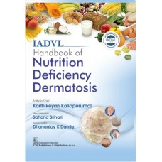 IADVL Handbook of Nutrition Deficiency Dermatosis:1st Edition 2025 By Karthikeyan Kaliaperumal