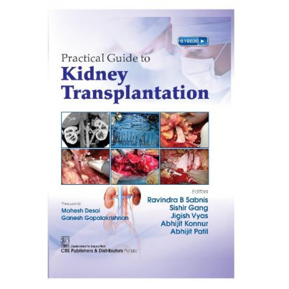 Practical Guide to Kidney Transplantation;1st Edition 2025 by Ravindra B Sabnis & Sishir Gang