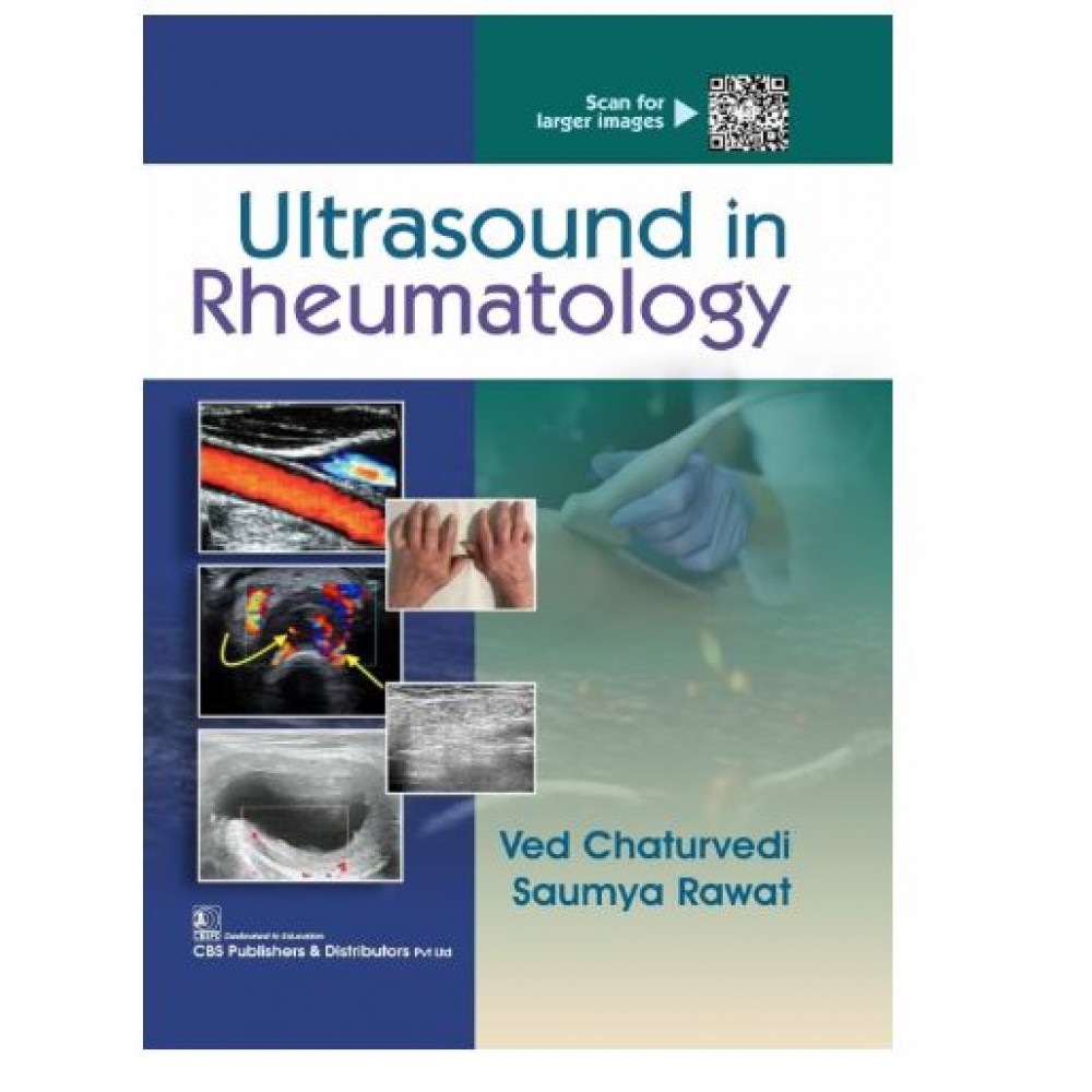 Ultrasound in Rheumatology;1st Edition 2026 by Ved Chaturvedi & Saumya Rawat