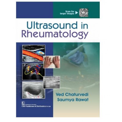 Ultrasound in Rheumatology;1st Edition 2026 by Ved Chaturvedi & Saumya Rawat