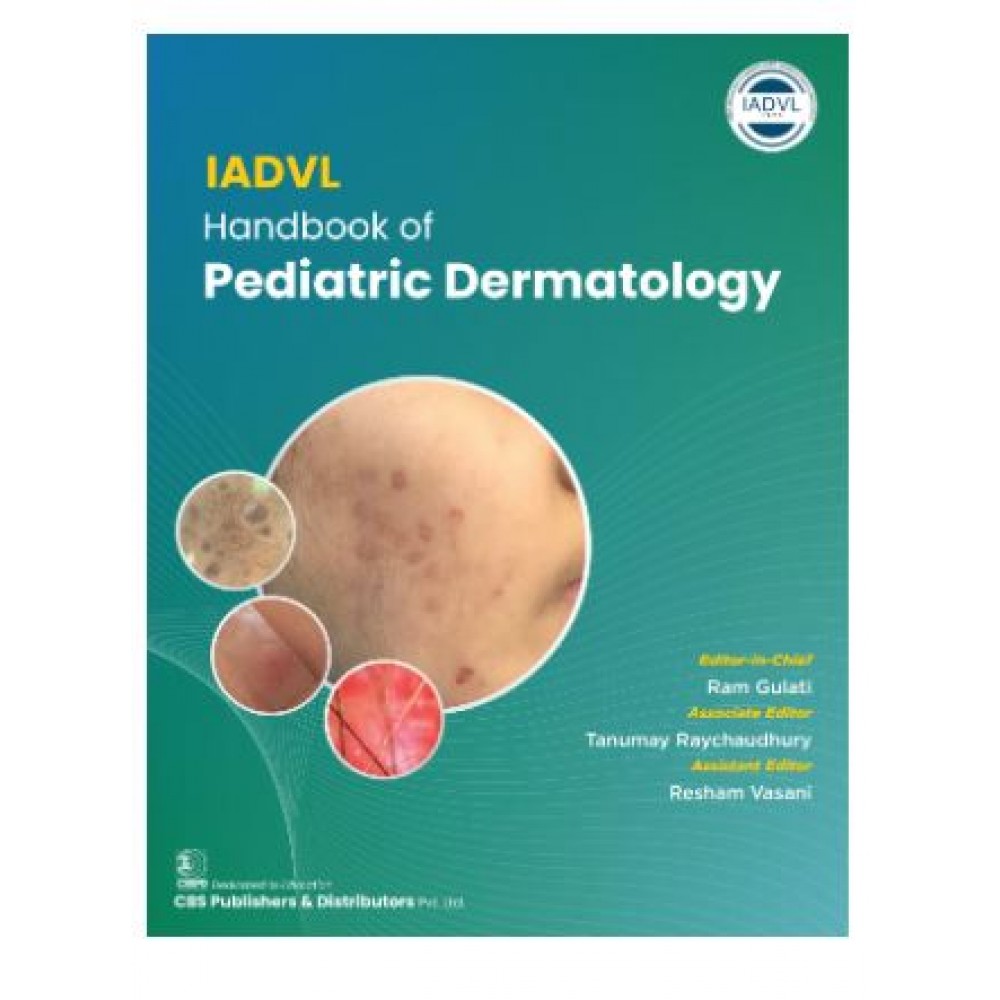 IADVL Handbook of Pediatric Dermatology;1st Edition 2025 by Ram Gulati, Tanumay Raychaudhary & Resham Vasani