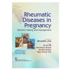 Rheumatic Diseases in Pregnancy Decision Making and Management;1st Edition 2026 by Nivedita Jha, Divya MB, Aishwarya Gopal, Ranjan Gupta & Ajay Kumar Jha