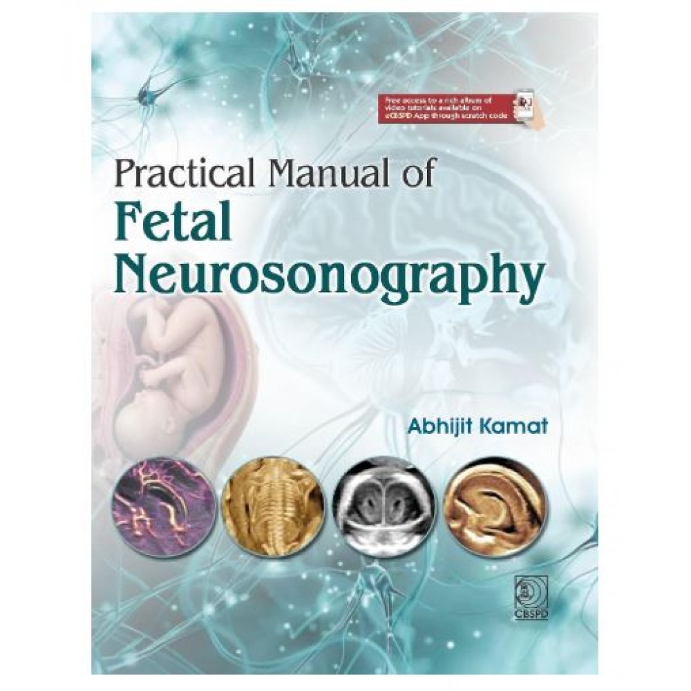 Practical Manual of Fetal Neurosonography;1st Edition 2027 by Abhijit Kamat